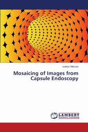 Mosaicing of Images from Capsule Endoscopy, Maciura Łukasz